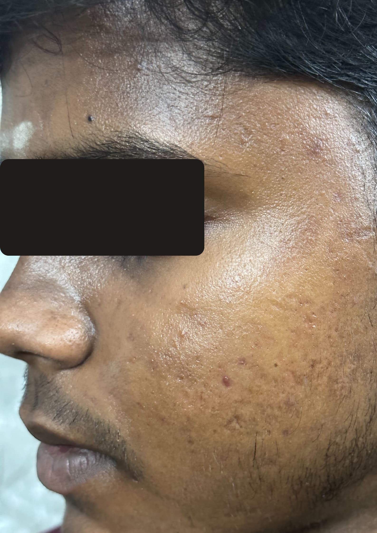 After treatment