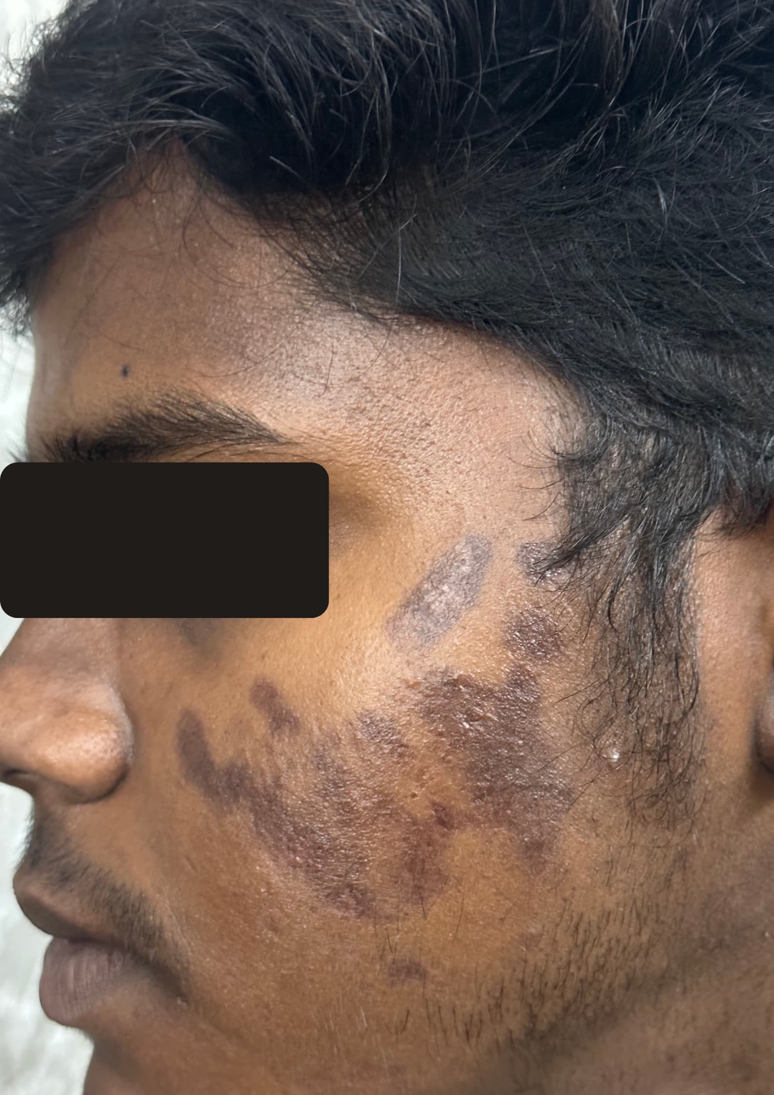 Before treatment